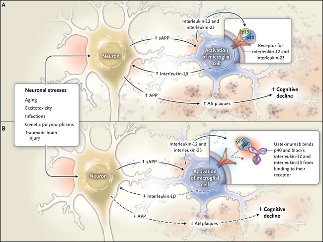 Interacción entre neuronas y microglía en enfermedades neurodegenerativas
