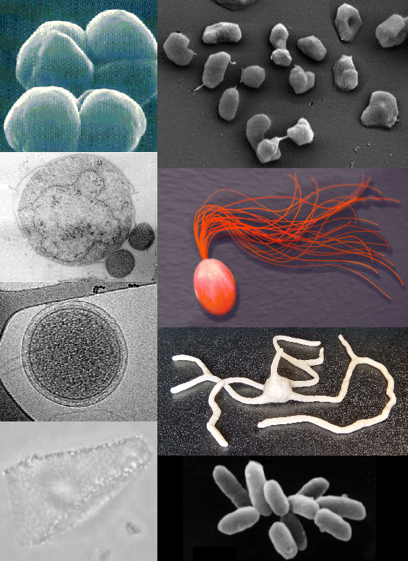 Imágenes microscópicas de diferentes tipos de arqueas