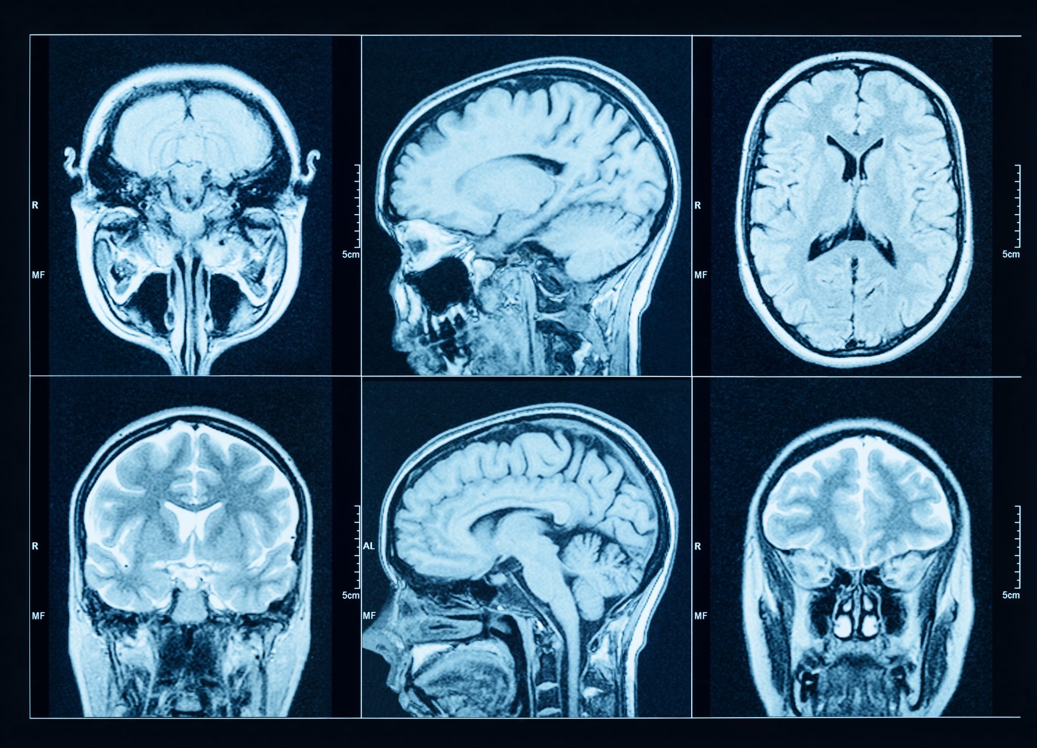 Brain scan visualization
