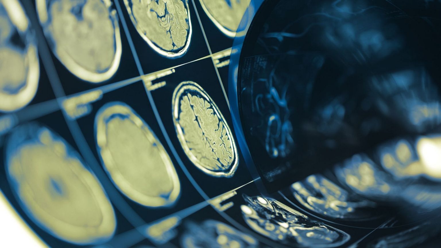 Resonancia magnética del cerebro mostrando actividad neuronal