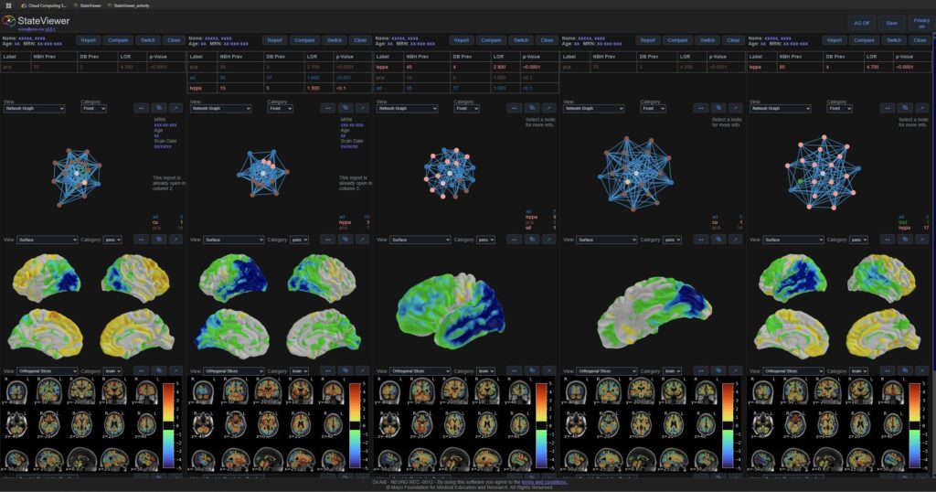 Visualización compleja de datos de investigación cerebral