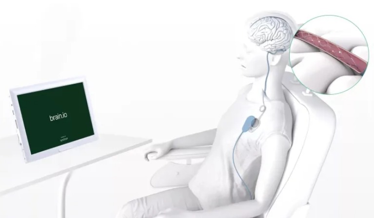 Dispositivo de interfaz cerebro-computadora mostrando señales cerebrales