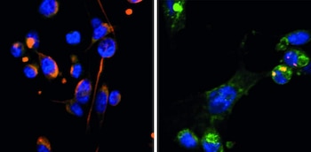 Células bajo microscopio fluorescente